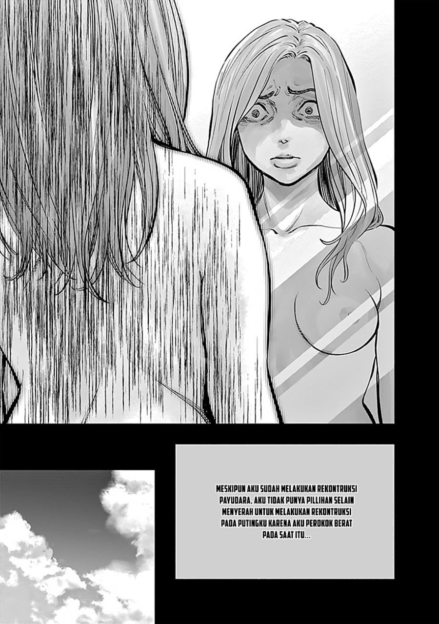 Radiation House Chapter 14 Gambar 15