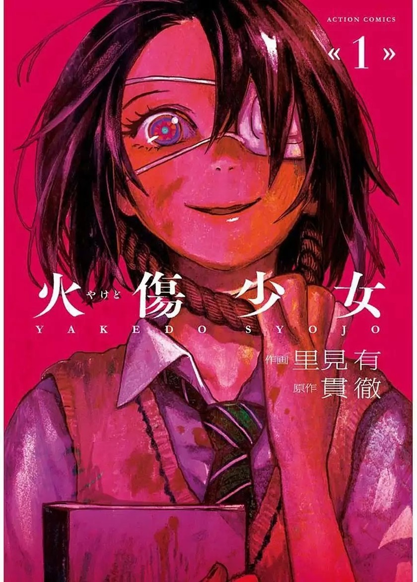 Yakedo Shoujo Chapter 01 Gambar 2